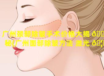 广州颈部除皱手术价格大揭 🐕 秘(广州面部除皱方法 激光 🦍 )